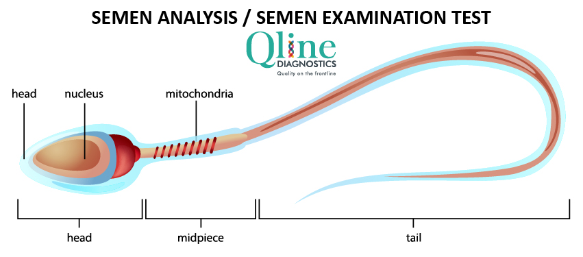 Semen analysis or semen examination test