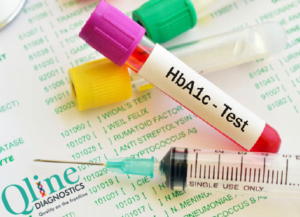 hba1c test in ahmedabad