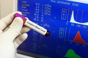 complete-blood-count CBC test ahmedabad