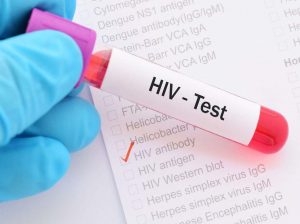 HIV AIDS testing center ahmedabad
