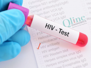 hiv aids testing center ahmedabad gujarat