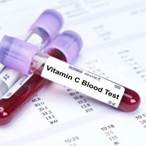 vitamin c blood test ahmedabad