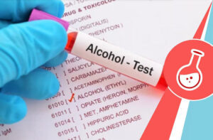 Alcohol blood urine test
